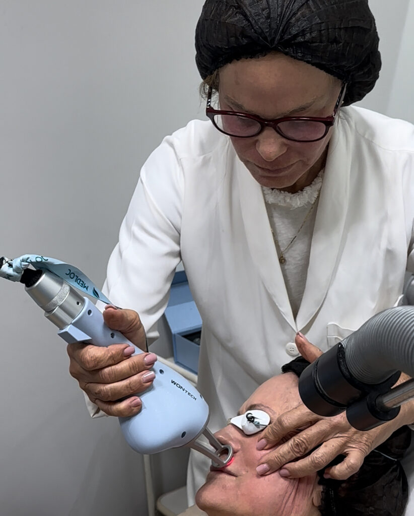 Dra Ana Pia, dermatologista fazendo laser Thulio