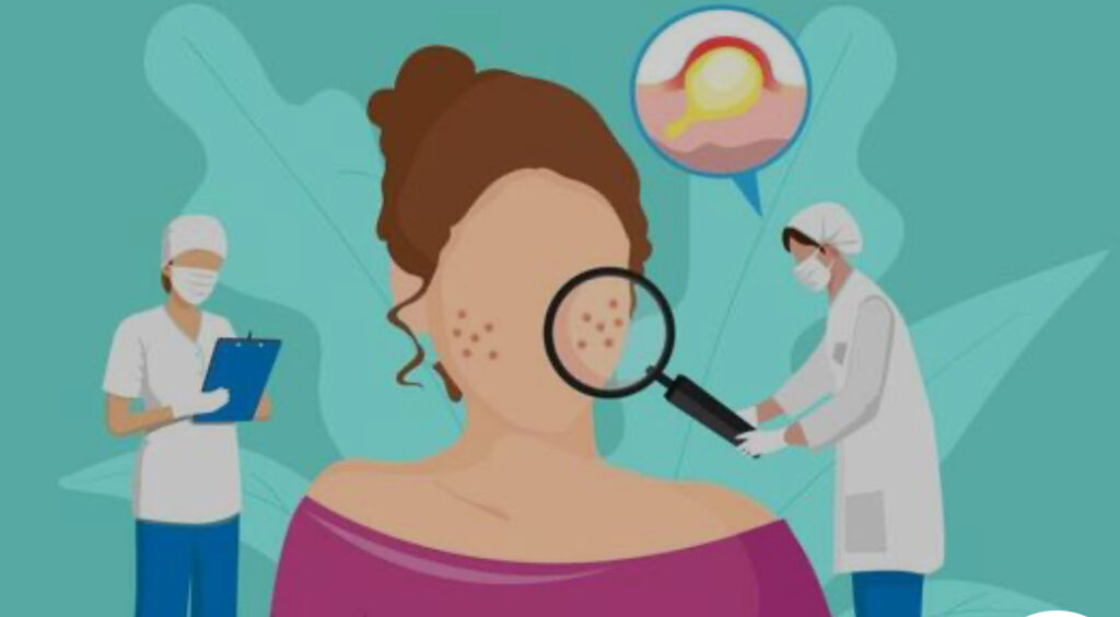 Dermatologista examinando acne com lupa