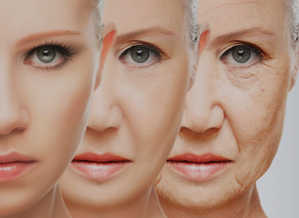 evolução de uma face de mulher com o envelehecimento. Cada fase fara um tipo de rejuvenescimento.