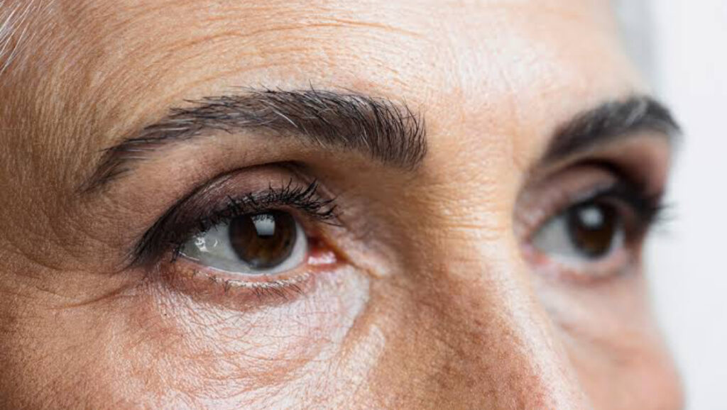 rejuvenescimento - olhos cansados