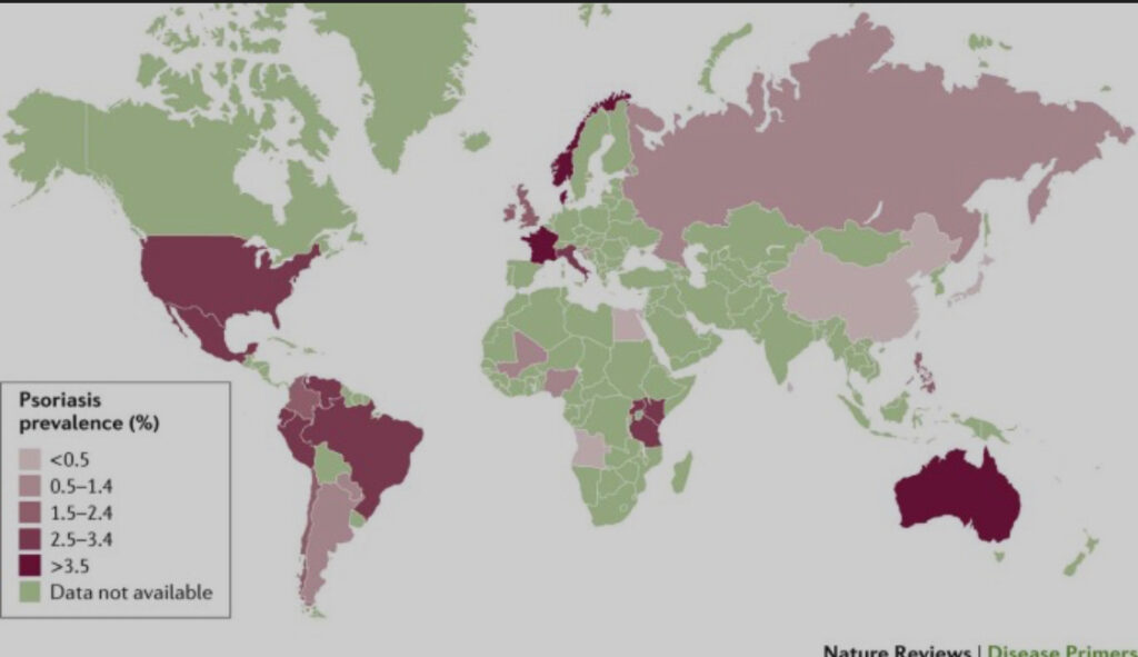 Distribuição da Psoríase no Mundo