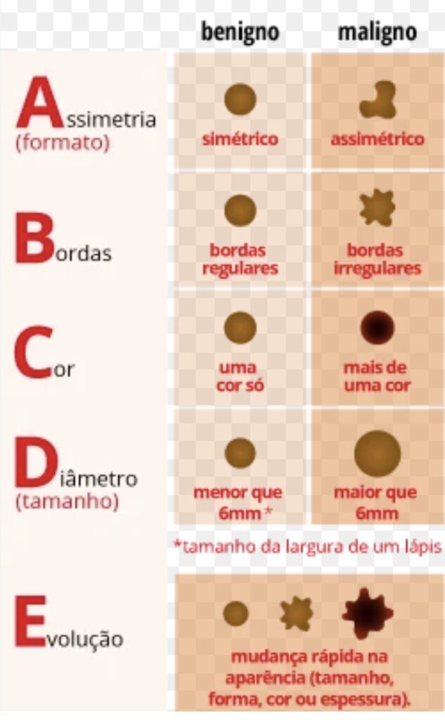 câncer de pele. Estadiamento melanoma