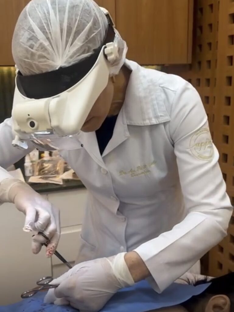 Dra Ana Pia fazendo remoção cirurúrgica de câncer de pele